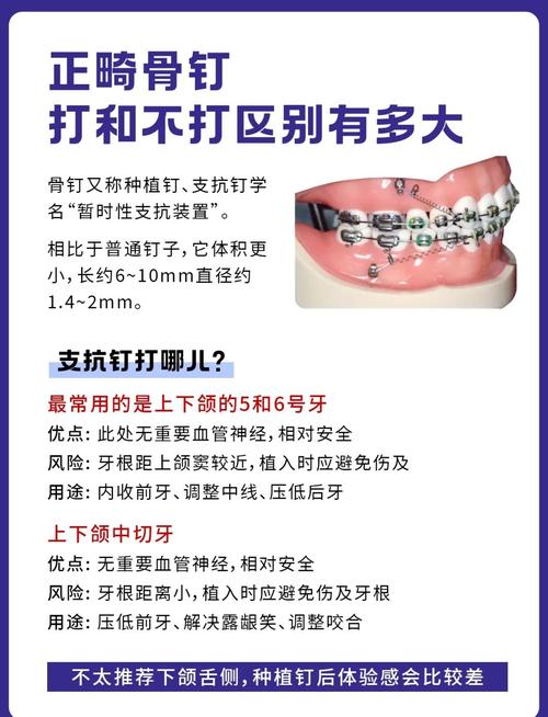 牙齿矫正打骨钉的作用究竟是什么？为何如此关键？-图1