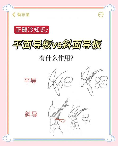 矫正牙齿的斜导是什么-图3