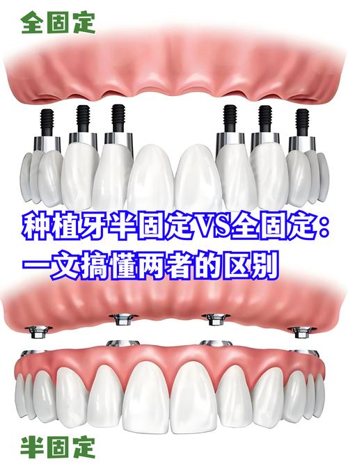 种植牙后还能做牙齿矫正吗？-图1