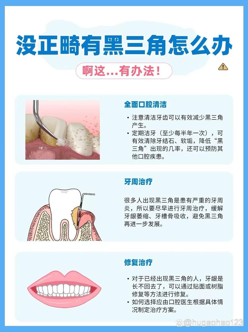 矫正牙齿后黑三角出现，到底该怎么办？-图2