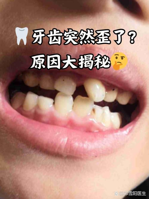 一颗牙齿歪斜不整齐，影响美观和咬合，究竟能不能矫正呢？-图3