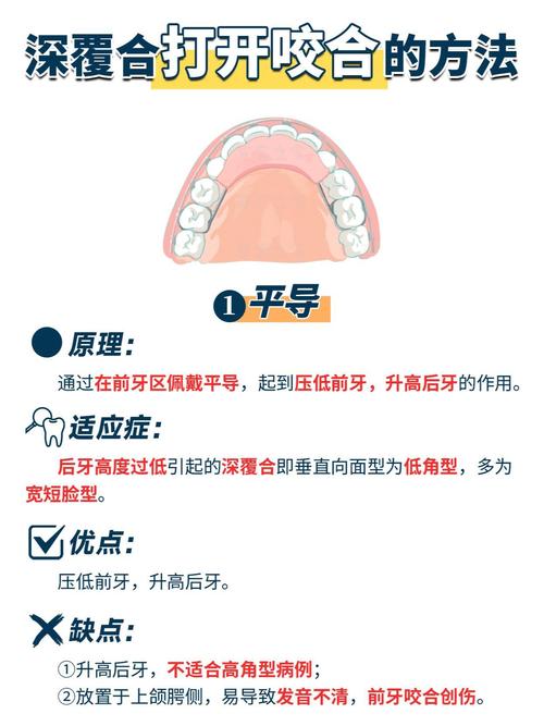 反合牙齿矫正器如何正确佩戴？-图1