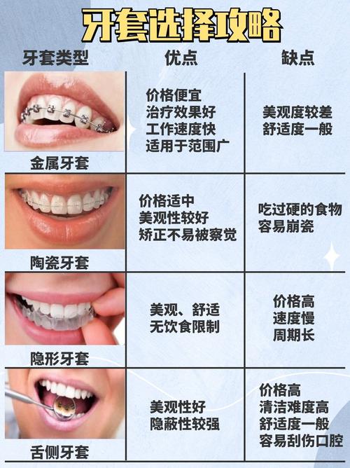 矫正牙齿的成本究竟是多少？不同矫正方式价格差异大吗？-图3