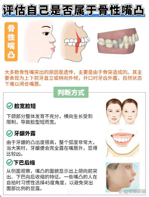 牙齿骨骼突出能矫正吗？专家解答矫正方法与可行性-图3