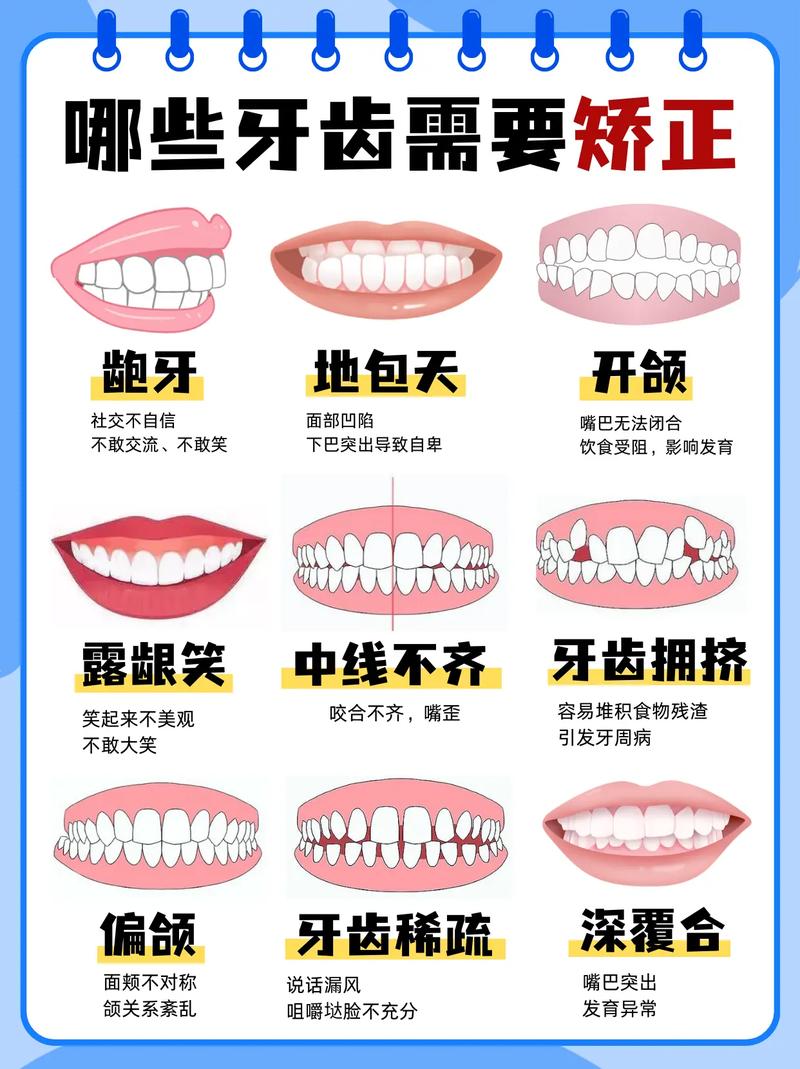 牙齿矫正与正畸有何区别？-图3