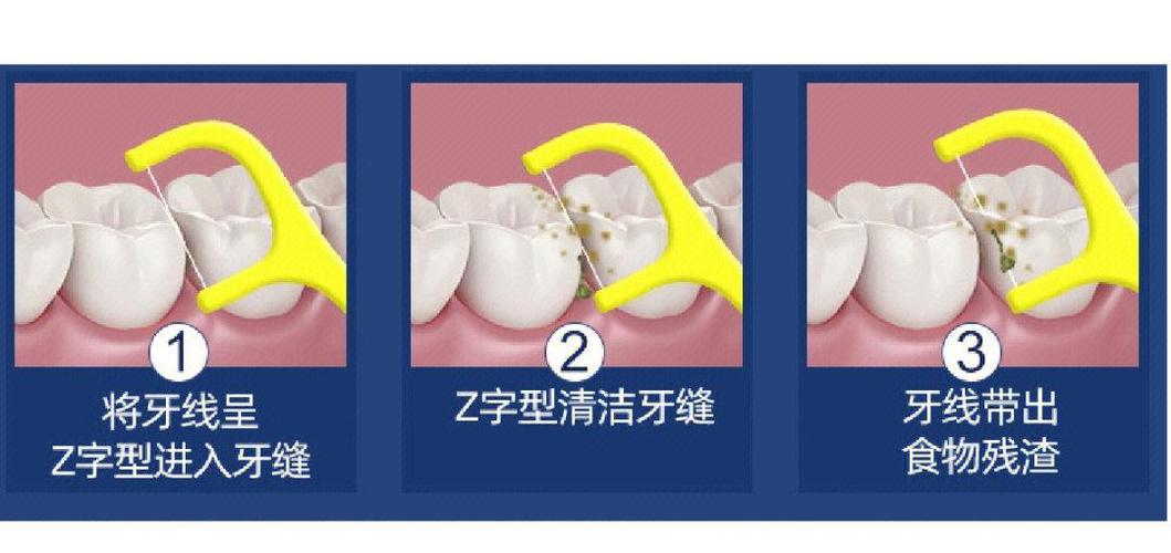 牙齿矫正中线不齐该怎么处理?-图1 牙齿矫正中线不齐该怎么处理?-图1