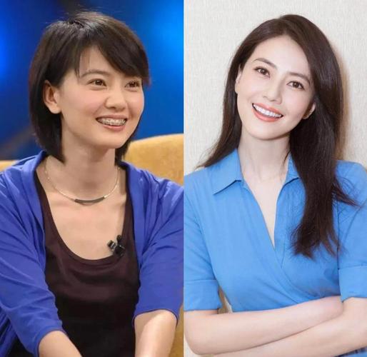 高圆圆27岁矫正牙齿,为何现在才整?-图1 高圆圆27岁矫正牙齿,为何现在才整?-图1