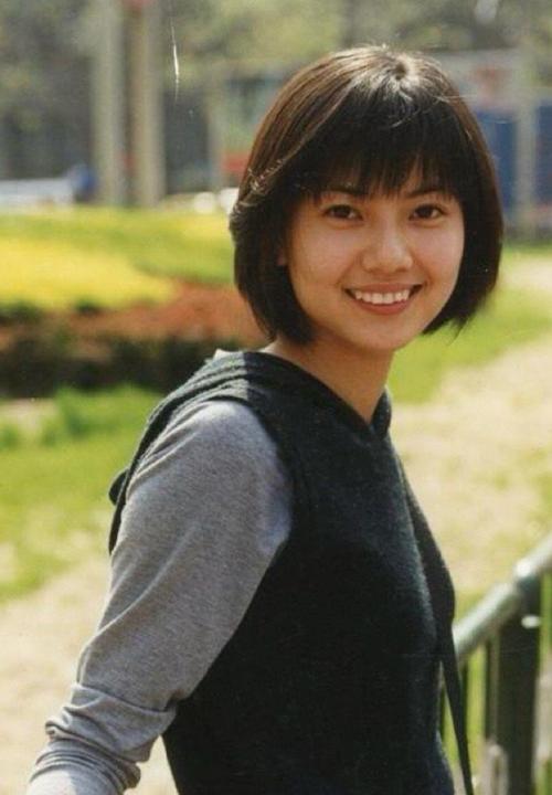 高圆圆27岁矫正牙齿,为何现在才整?-图2 高圆圆27岁矫正牙齿,为何现在才整?-图2