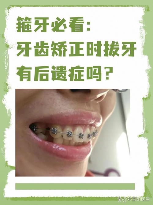 拔牙矫正牙齿过程图片能看清哪些关键步骤？-图3