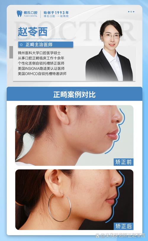 矫正牙齿能改善嘴突吗？-图2