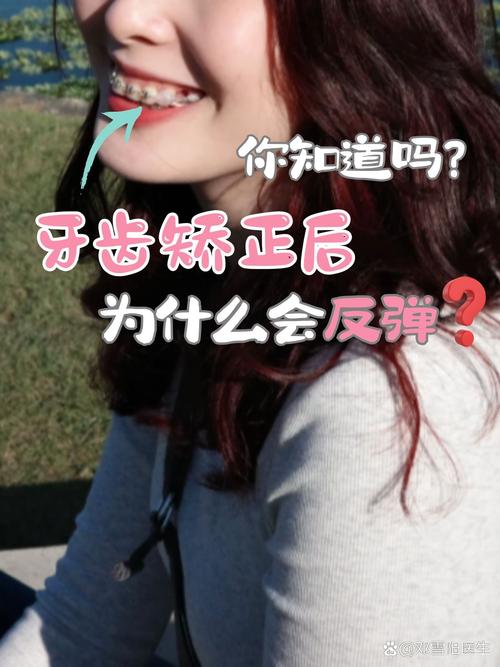 矫正牙齿后，反弹概率高吗？如何有效避免反弹？-图2
