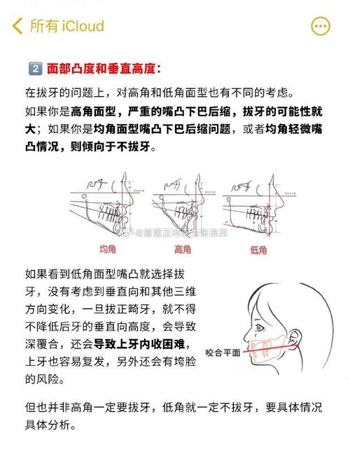 牙齿矫正拔牙的危害，你真的了解吗？-图3