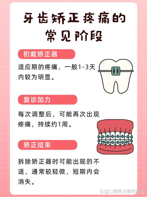 矫正牙齿哪个过程最疼-图2