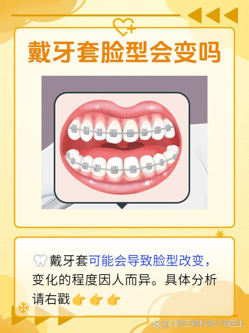 牙齿矫正对脸型的影响有多大？真能改变脸型吗？具体会有哪些变化？-图3