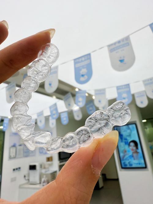 苏州口腔医院矫正牙齿-图1