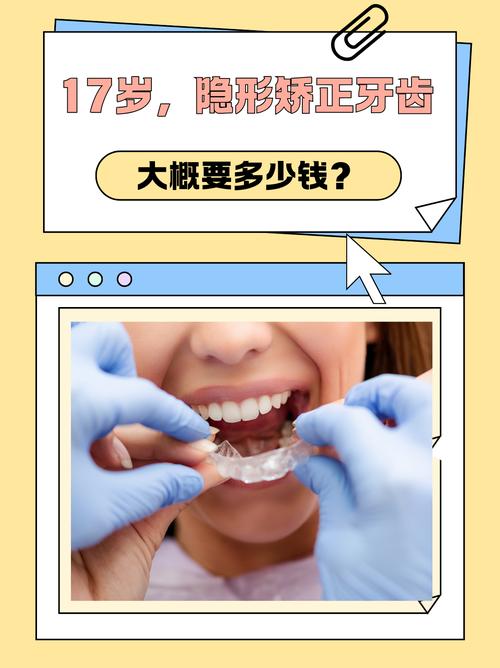 17岁矫正牙齿一般需要多长时间？-图1