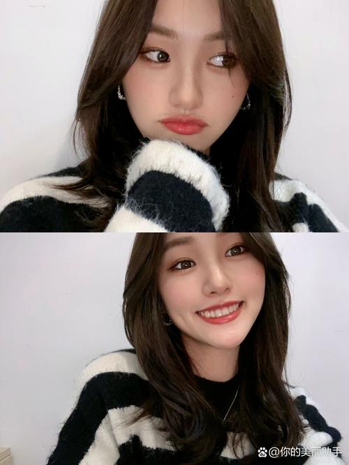 透明牙齿矫正器矫正牙齿效果真的有用吗？-图2