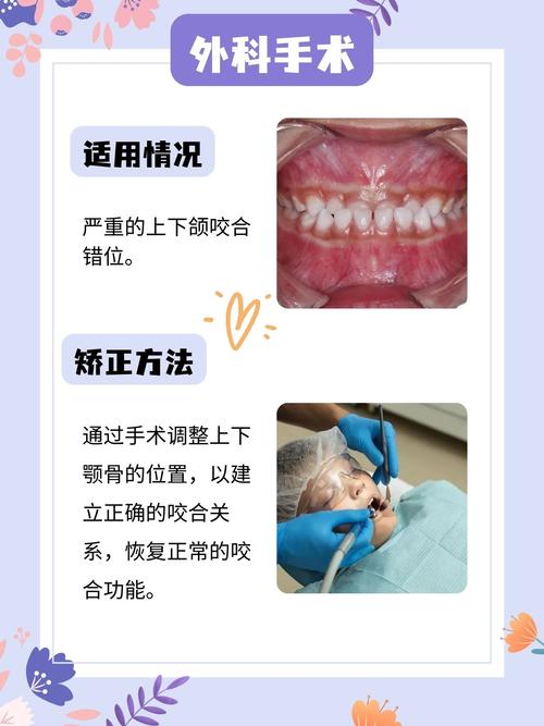 牙齿咬合错位矫正方法有哪些？-图2