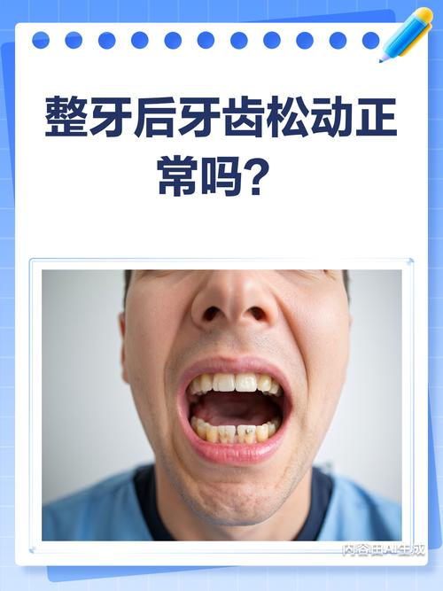 矫正过的牙齿老了会松动吗?-图1 矫正过的牙齿老了会松动吗?-图1