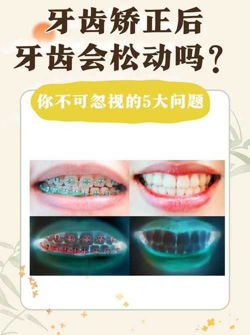 矫正过的牙齿老了会松动吗?-图2 矫正过的牙齿老了会松动吗?-图2