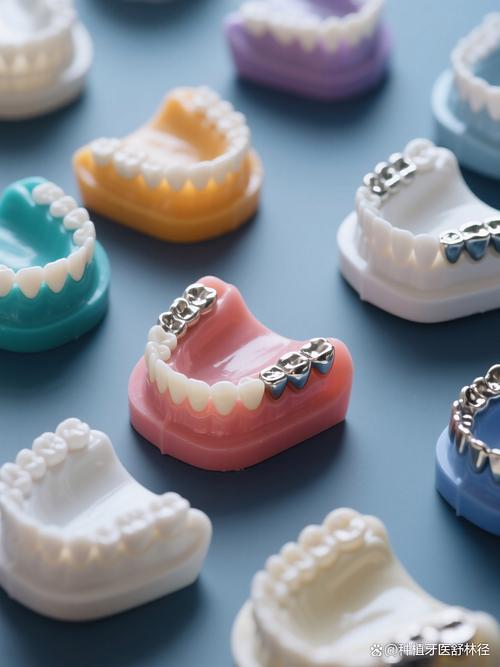 矫正牙齿的工具统称为什么?有哪些具体名称?-图2 矫正牙齿的工具统称为什么?有哪些具体名称?-图2