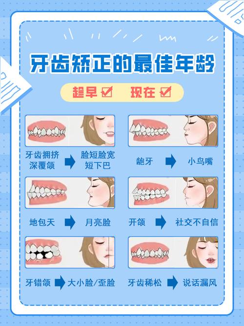 孩子牙齿矫正最佳年龄究竟在几岁最合适？-图3