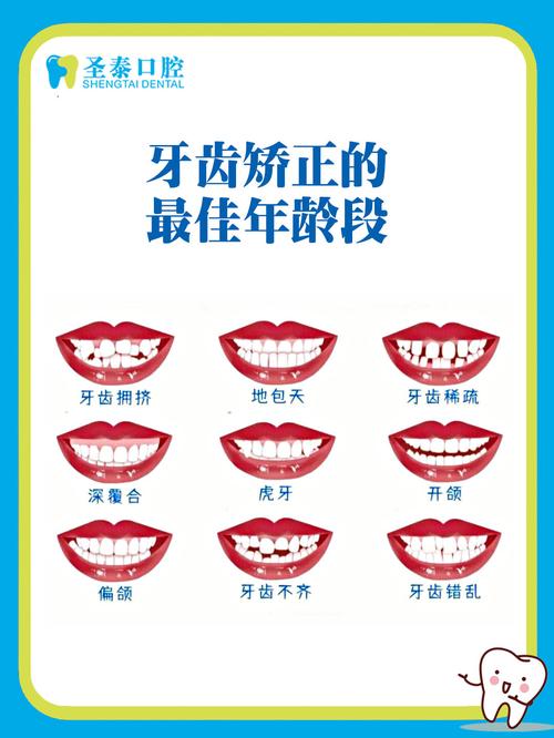 牙齿矫正的最佳年龄是几岁？几岁开始最合适？-图1