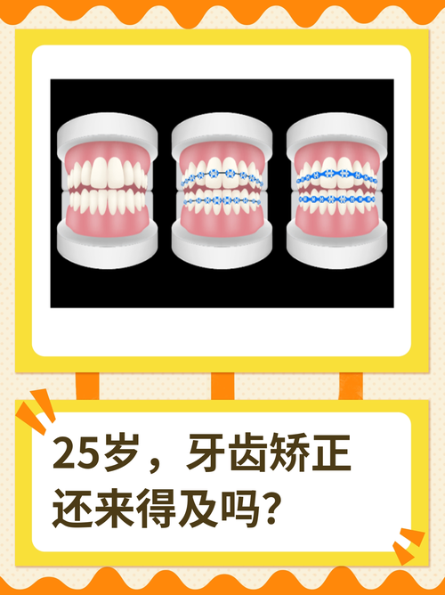 25岁矫正牙齿还来得及吗？成年人矫正的最佳时机是什么时候？-图1