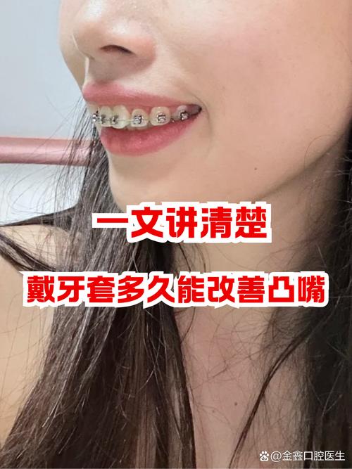 不戴牙套怎么矫正牙齿-图2