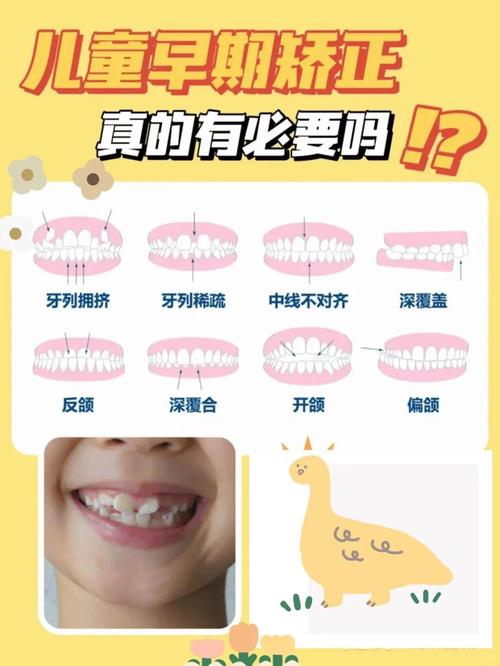 小孩矫正牙齿的最佳时间是什么时候？-图3