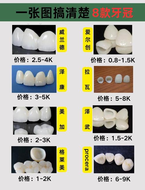 美容冠牙齿矫正一般要花多少钱？-图1