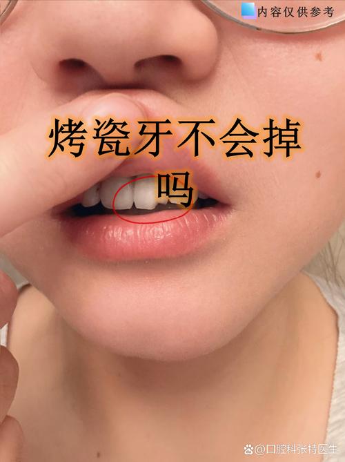 烤瓷牙能用来矫正牙齿吗？-图1