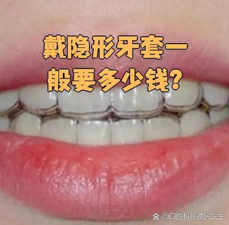 隐形矫正牙齿费用大概多少？-图3
