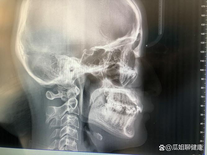 矫正牙齿选哪家医院最好？如何判断哪家靠谱？-图3