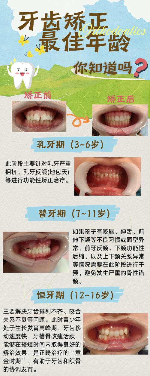 儿童牙齿矫正的最佳年龄是什么时候？越早越好吗？-图2