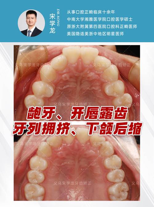 矫正牙齿选白龙牙医效果靠谱吗？-图3
