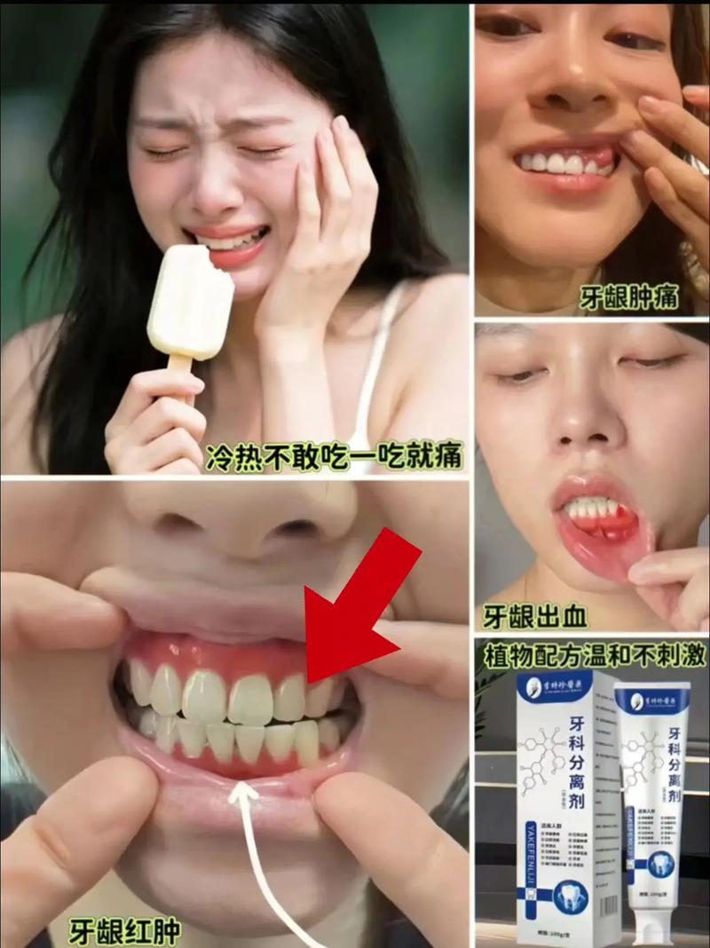 矫正牙齿会导致牙龈萎缩吗？-图2