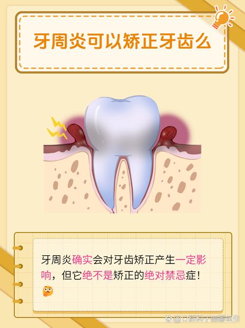 矫正牙齿真能改善牙周炎吗？-图2