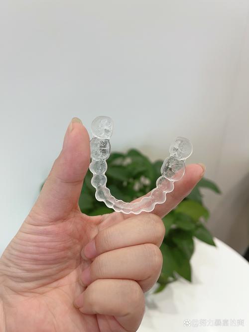 牙齿矫正 但是出国-图3