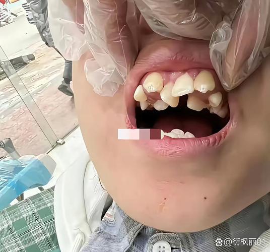 佳木斯矫正牙齿去哪做？靠谱机构怎么选？-图3