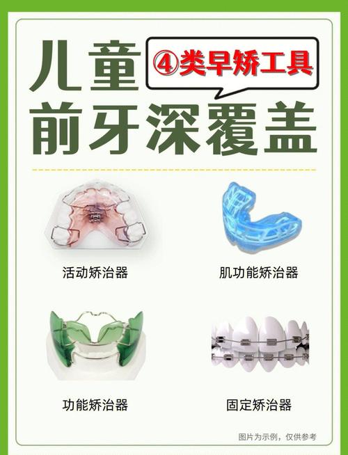 儿童牙齿矫正活动，家长如何判断孩子是否需要参与矫正？-图2