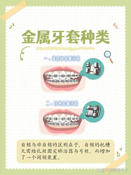 牙齿矫正器矫正牙齿的原理究竟是如何实现的？-图3