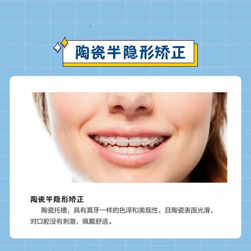 矫正牙齿时，究竟需要拔除哪些牙齿呢？-图3