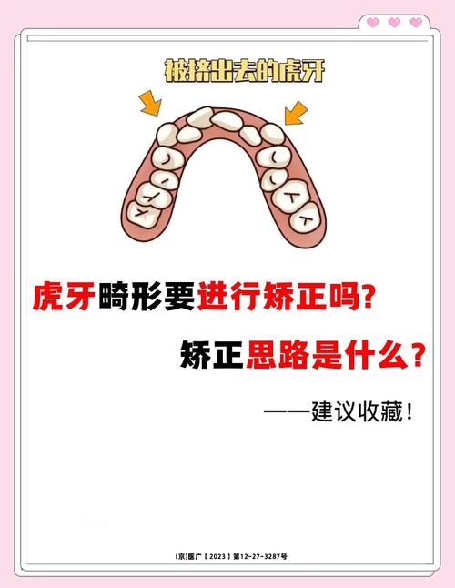 虎牙不矫正，真的不用管吗？-图1