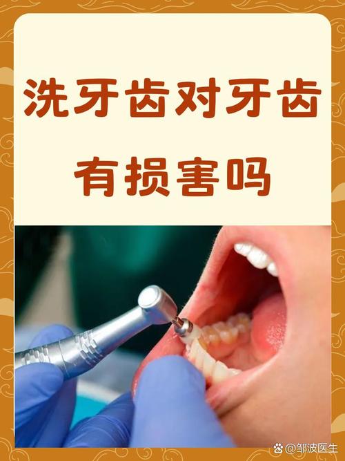 牙齿矫正期间可以洗牙吗？-图3