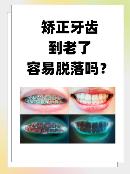 哪些牙齿矫正难度大？原因有哪些？-图3