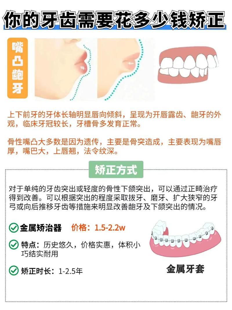 牙齿自锁矫正一般需要多少钱？-图2