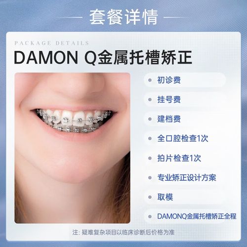 拜博矫正牙齿怎么样？效果、体验和口碑真实情况如何？-图1