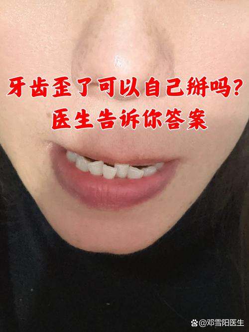 牙齿太歪了影响咀嚼和美观，能矫正吗？-图3