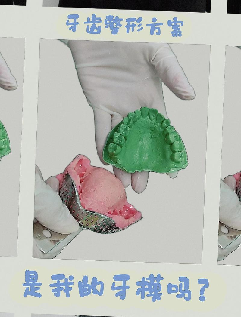 牙齿矫正做牙膜干啥-图1